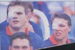 ... as Paul Harragon go down to amusingly simlar right eye injuries.